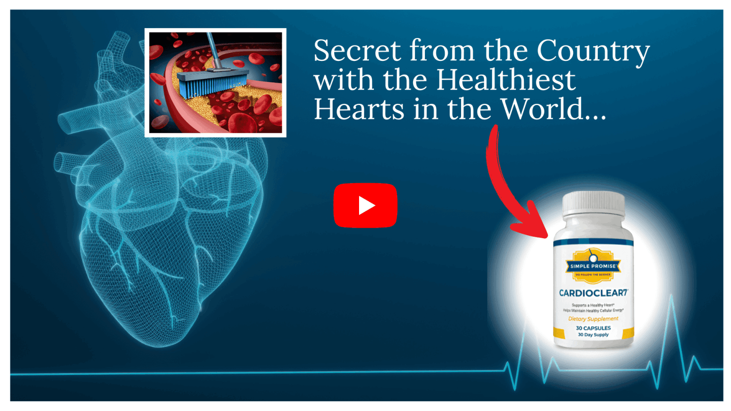 How to Clear Artery Plaque Naturally